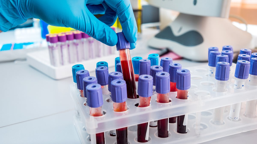 Groundbreaking Advances in Alzheimer's Diagnosis: Blood Tests for Early Detection 2