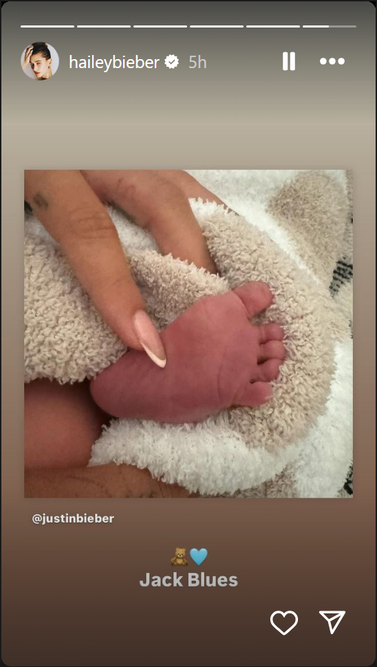 Justin Bieber and Hailey Welcome Their First Baby: Jack Blues Bieber 2 Justin Bieber and Hailey Welcome Their First Baby: Jack Blues Bieber
