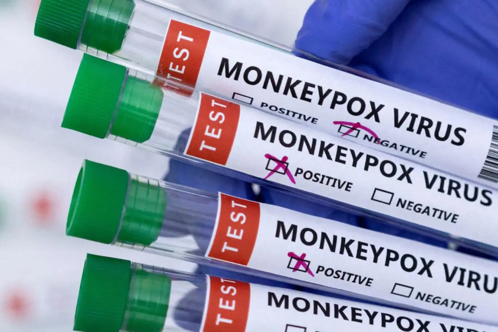 A standard mpox testing kit.