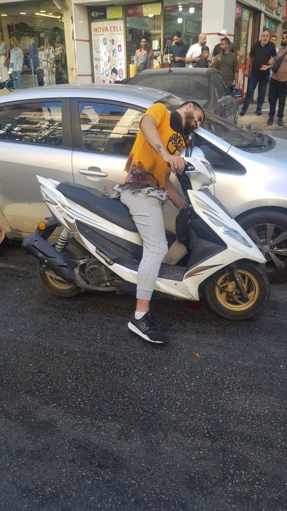 Walkie-Talkie Explosions In Lebanon: A New Chapter In The Israel-Hezbollah Conflict 1 One of the Lebanese civilian was badly injured during the first wave of attack on Hezbollah members as the pager in his pants exploded. (Source: X / Twitter)