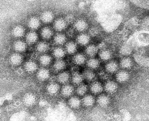 Norovirus Outbreaks: Here’s What You Need to Know 1 The microscope image provided by the CDC shows a cluster of Norovirus virions. (Image Credit: Charles D. Humphrey / CDC)