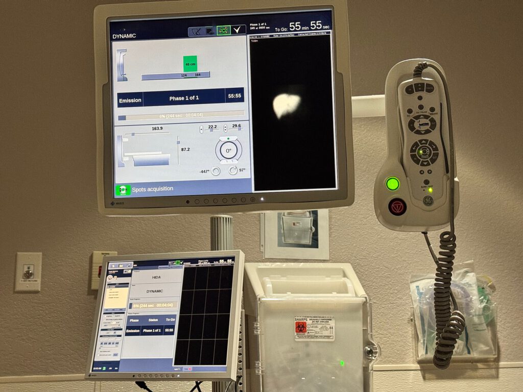 AI Detects Pancreatic Cancer Years Before Symptoms Appear 2 A nuclear medicine machine is used for medical imaging in a hospital in North Carolina 07