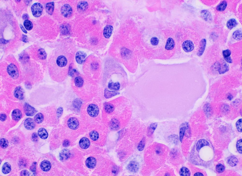 Histology of anterior pituitary eosinophilic follicles