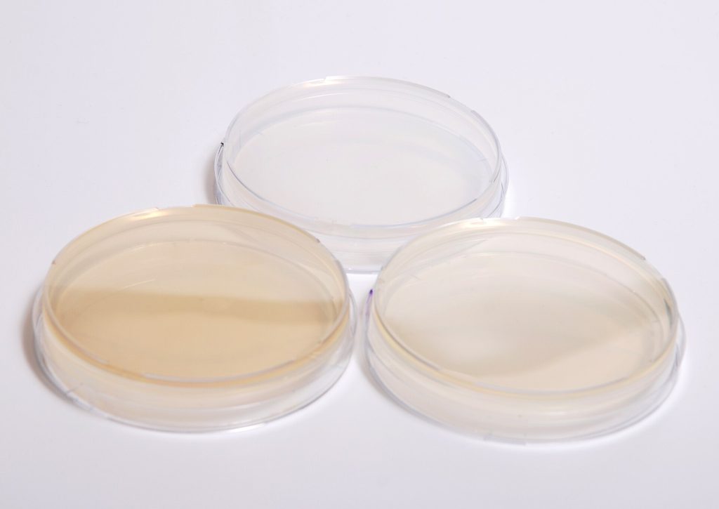 Cellular Recycling Paradox: Autophagy Does Not Simply Decline With Age 2 Agar plates different types