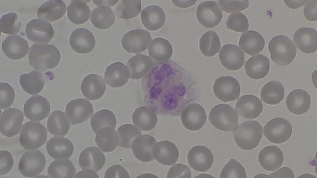 Red blood cells (RBCs), platelets and white blood cells or leukocyte (neutrophil) on PBS