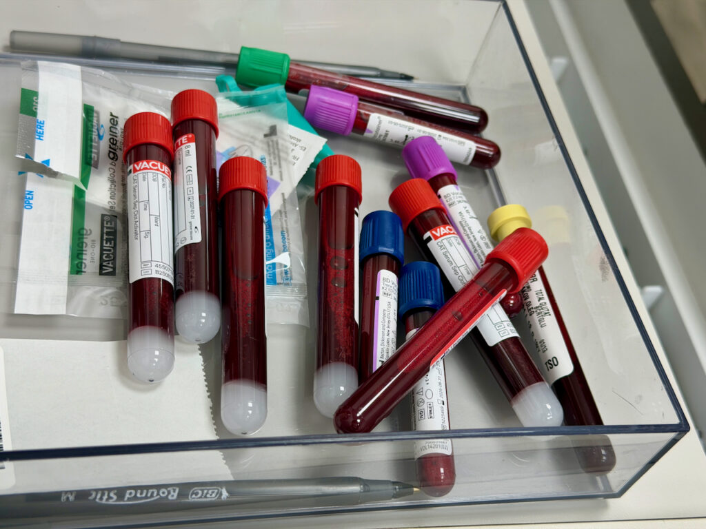 Is ‘Ferritin Face’ Real? Doctors Weigh In on Social Media Trend Blood test tubes and iron supplements on a medical table