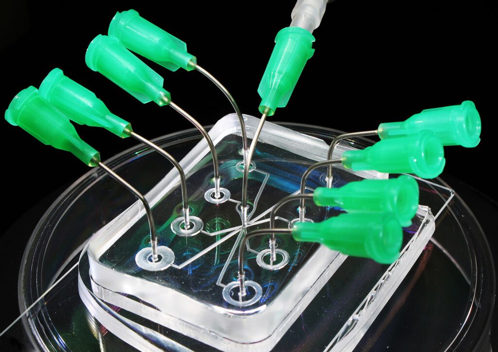 Thick Fluid Makes Glioblastoma Cells More Aggressive Microscopic view of glioblastoma cells navigating through a microfluidic chip with tiny pillars