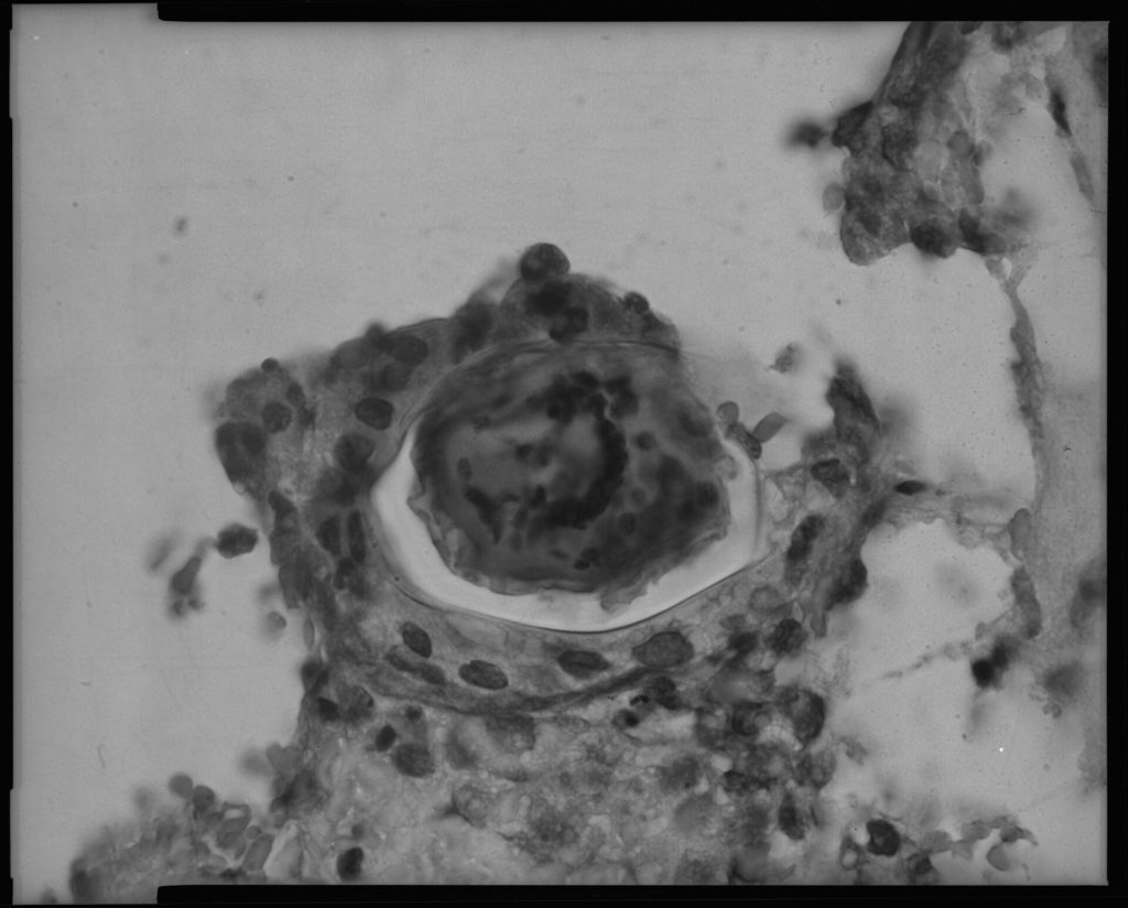 Microscopic view of brain inflammation and P2X7 receptor activity