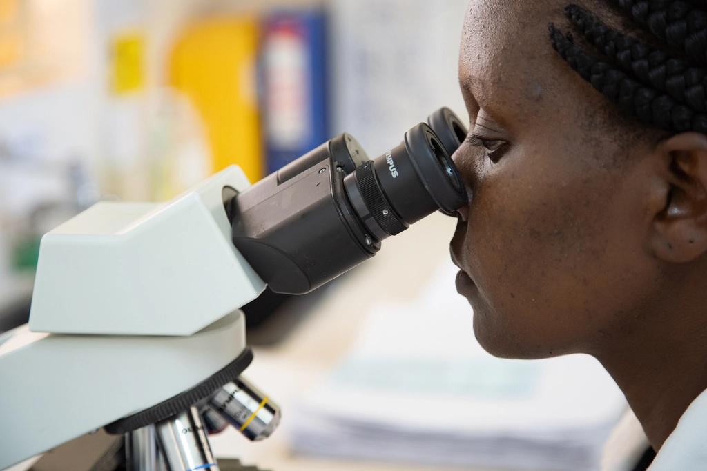 Personalised Cancer Vaccine Cuts Melanoma Death or Recurrence Risk by 42% 3 Laboratory Technologist Caren Cherotich (31