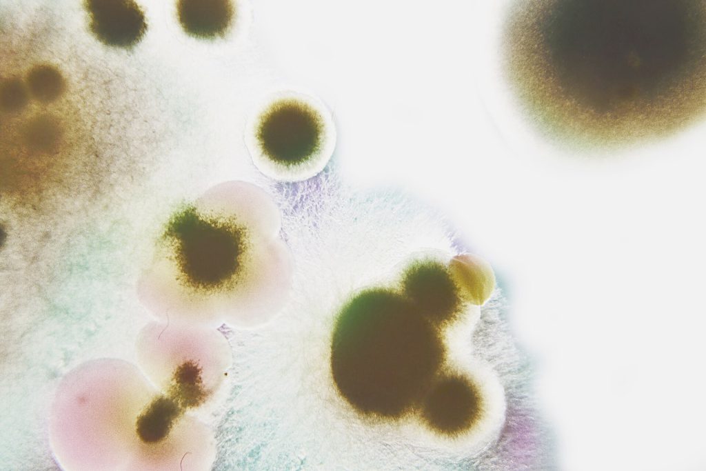 Post-COVID Taste Loss Linked to Taste Bud Changes Microscopic view of taste bud cells showing structural disorganization