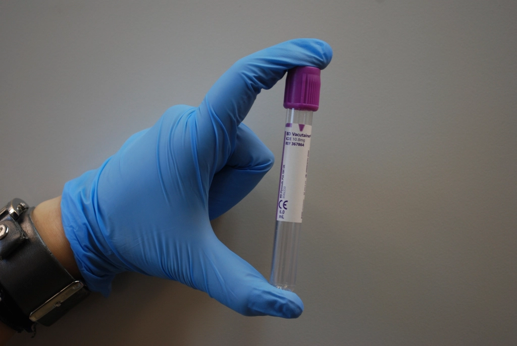 Psilocybin Study Shows Reduced Inflammation in Parkinson's Patients 1 Lab tube