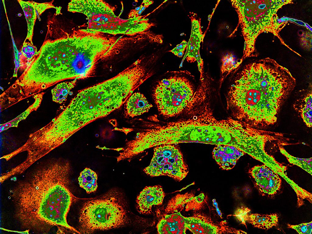 German Scientists Reverse 60 Years of Aging in Human Cells 2 Epithelioid cells and macrophages in cell culture