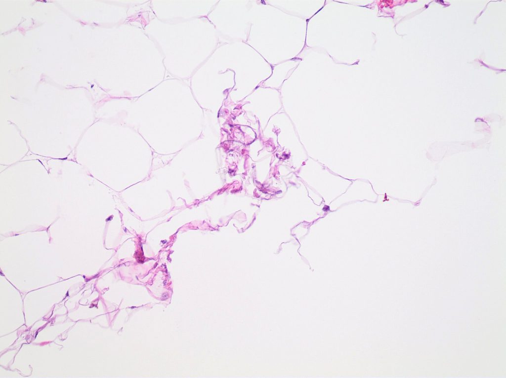 One Week of Strength Training Shrinks Fat Cells in Mice Microscopic view of visceral fat cells shrinking after strength training