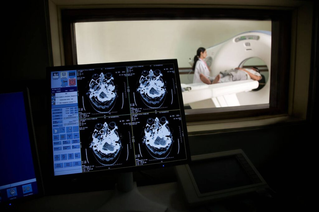 CT Brain Scan