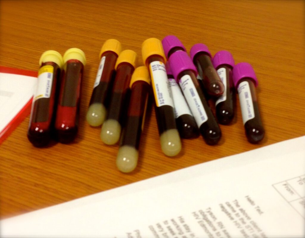 Rodney Rousseau first poz blood drawn. July